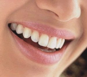 estetica dental 